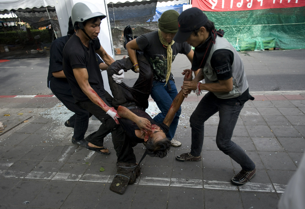 bangkok_burns13.jpg