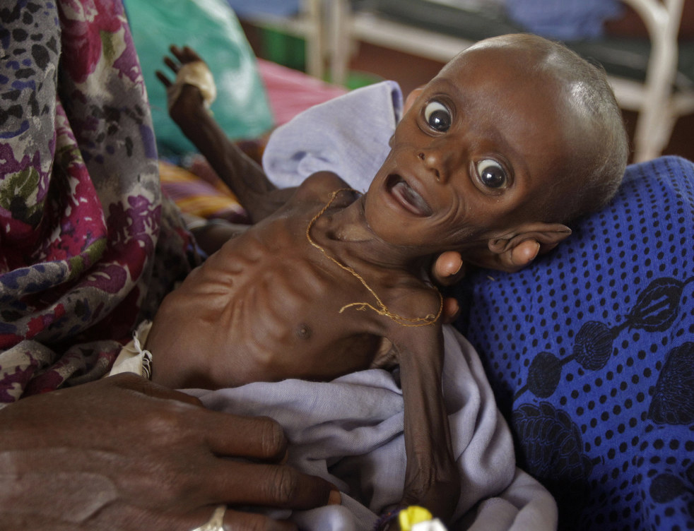 east_africa_famine_15.jpg