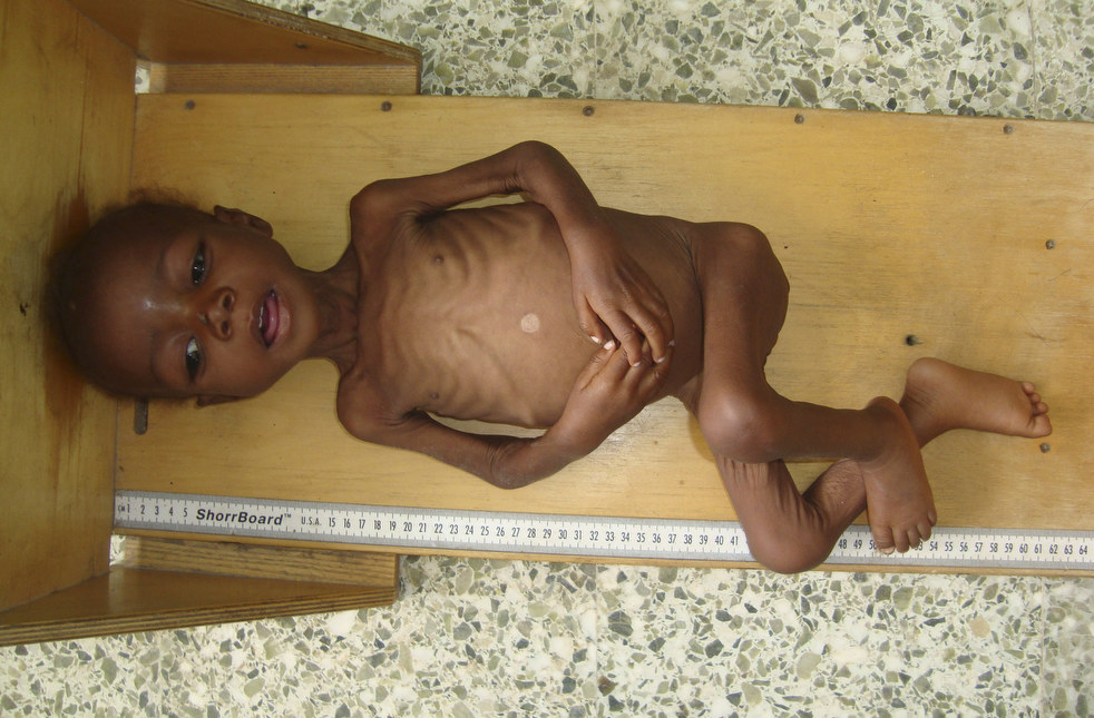 east_africa_famine_21.jpg